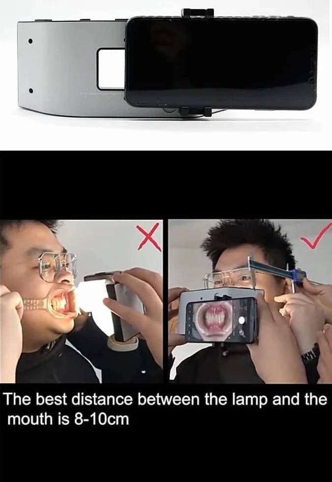 Mobilna lampa błyskowa do fotografii dentystycznej, 6500 K, mobilny uchwyt LED do fotografii stomatologicznej, ustne wyposażenie oświetlenia LED do wypełniania i fotografii mobilnej.