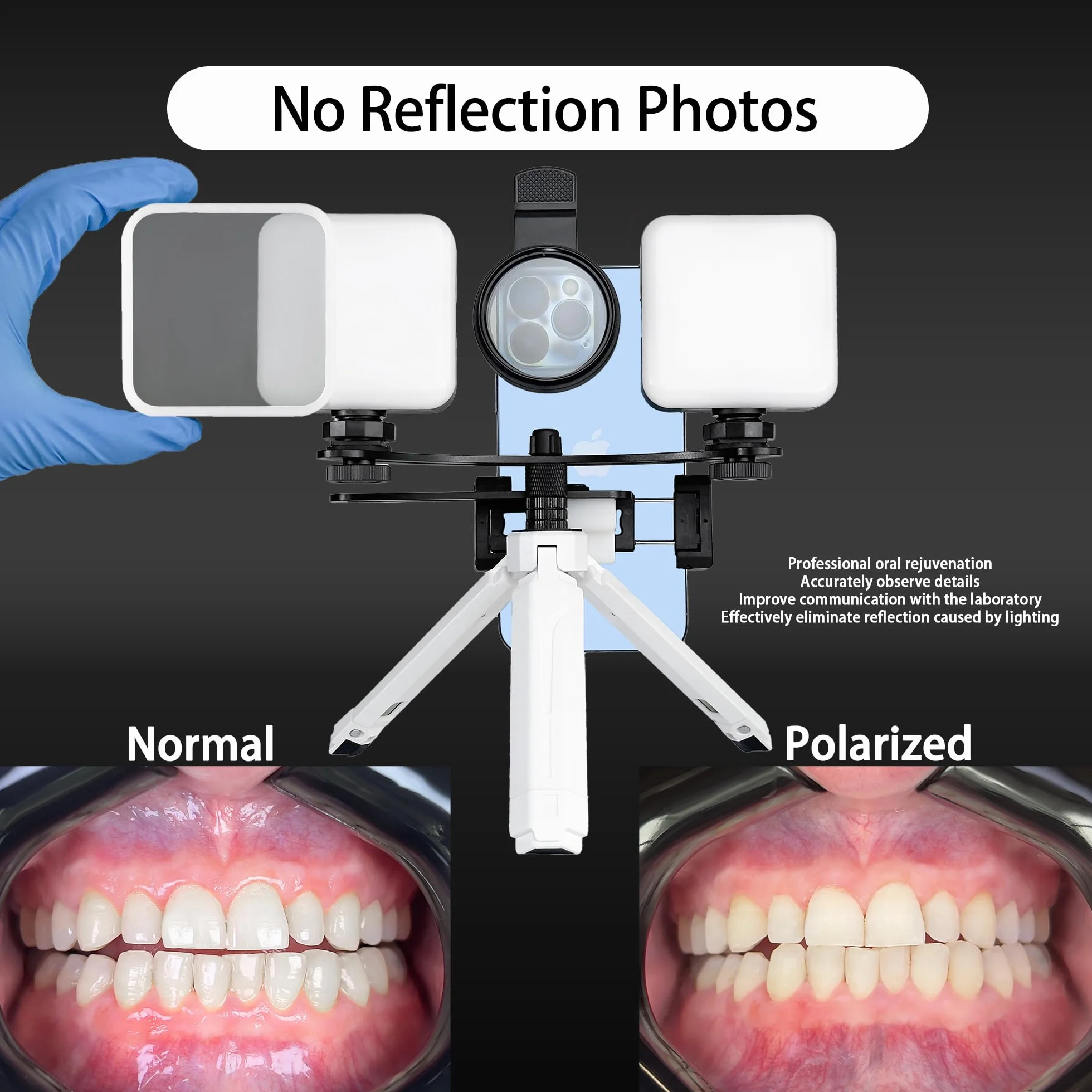 MK-19W dentystyczna lampa fotograficzna i wideo do smartfonów, lampa błyskowa do fotografii oralnej dla dentystów