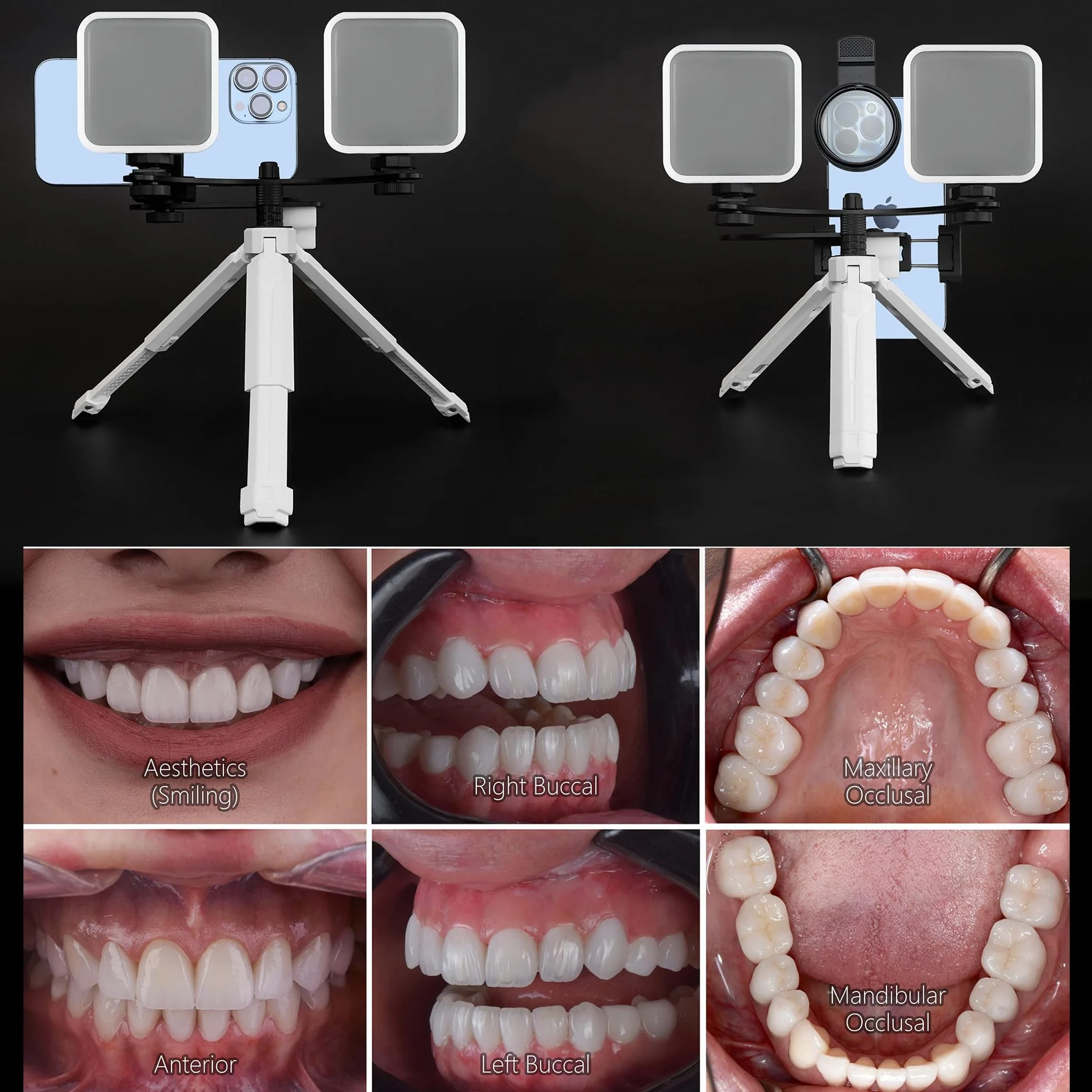 MK-19W dentystyczna lampa fotograficzna i wideo do smartfonów, lampa błyskowa do fotografii oralnej dla dentystów