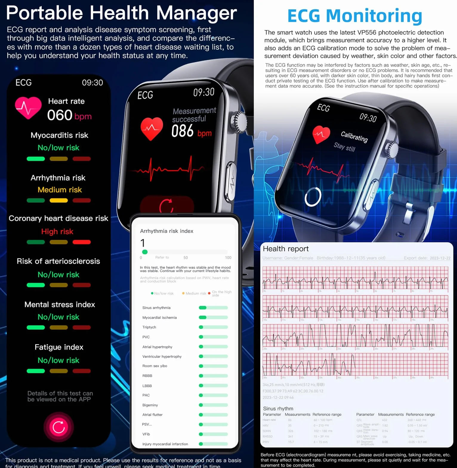 Zegarek do inteligentnego zarządzania zdrowiem F300, ekran HD 2,10 cala, z EKG, BMI, HRV, monitorowanie innych danych. Inteligentny zegarek do zarządzania z funkcją SOS jednym kliknięciem, dla