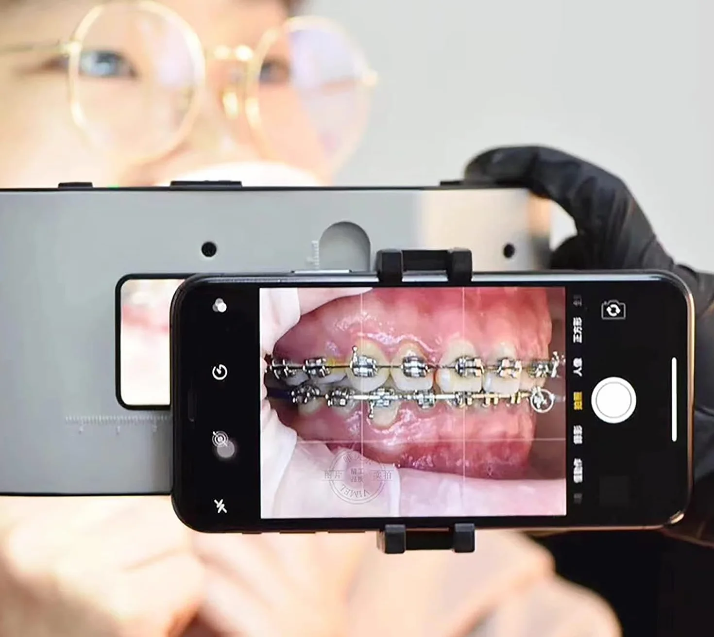 Mobilna lampa błyskowa do fotografii dentystycznej, 6500 K, mobilny uchwyt LED do fotografii stomatologicznej, ustne wyposażenie oświetlenia LED do wypełniania i fotografii mobilnej.